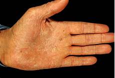Antibacteriel Soaps