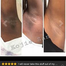 Dermatological Soap
