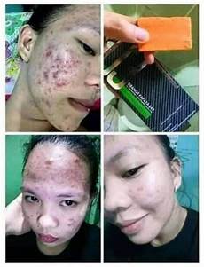 Dermatological Soap