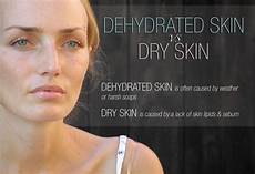 Dermatological Soap