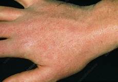 Dr Bronner Hand Sanitiser