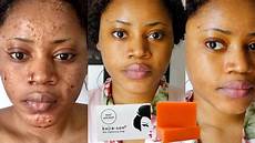Provon Antimicrobial Lotion Soap