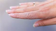 Sanitizer Soap